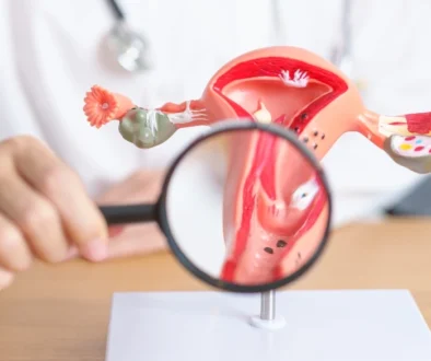 uterine fibroid treatment in sharjah